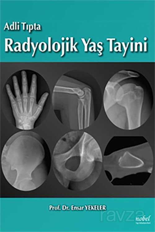 Adli Tıpta Radyolojik Yaş Tayini - 1