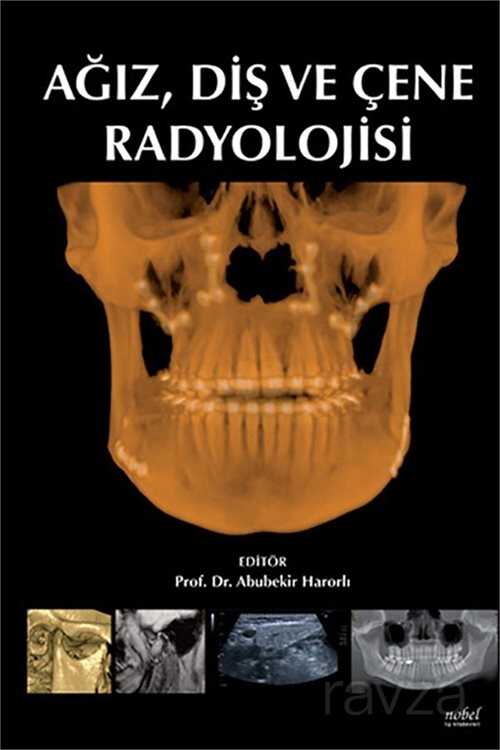 Ağız, Diş ve Çene Radyolojisi - Nobel Tıp Kitabevleri