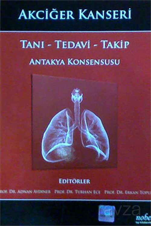 Akciğer Kanseri: Tanı - Tedavi - Takip - Antakya Konsensusu - Nobel Tıp Kitabevleri