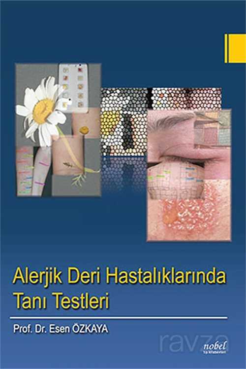 Alerjik Deri Hastalıklarında Tanı Testleri - 1