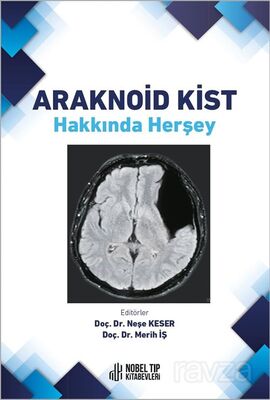 Araknoid Kist Hakkında Herşey - 1