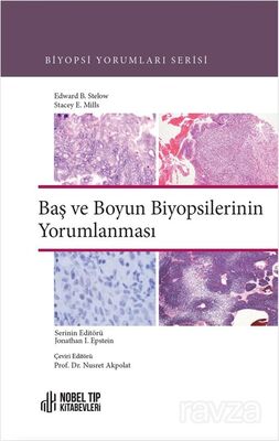 Baş ve Boyun Biyopsilerinin Yorumlanması - 1