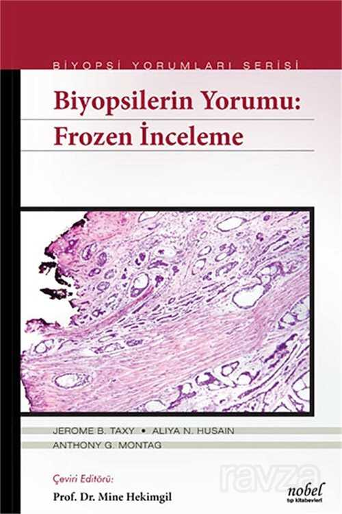 Biyopsilerin Yorumu: Frozen İnceleme - Biyopsi Yorumları Serisi - 1