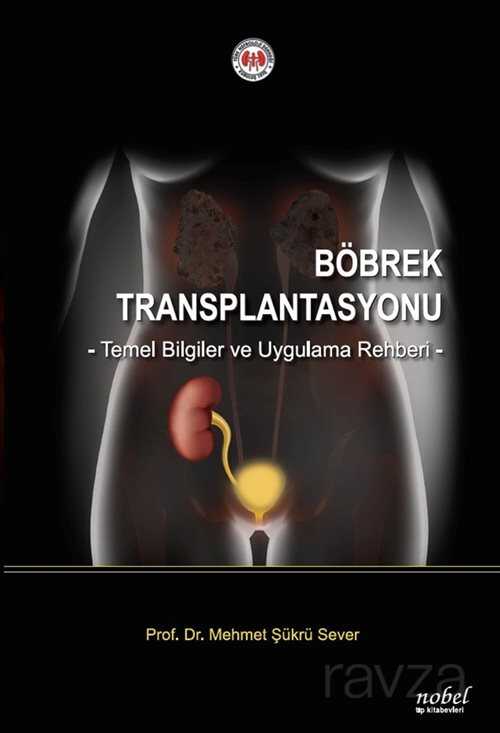 Böbrek Transplantasyonu Temel Bilgiler ve Uygulama Rehberi - 1