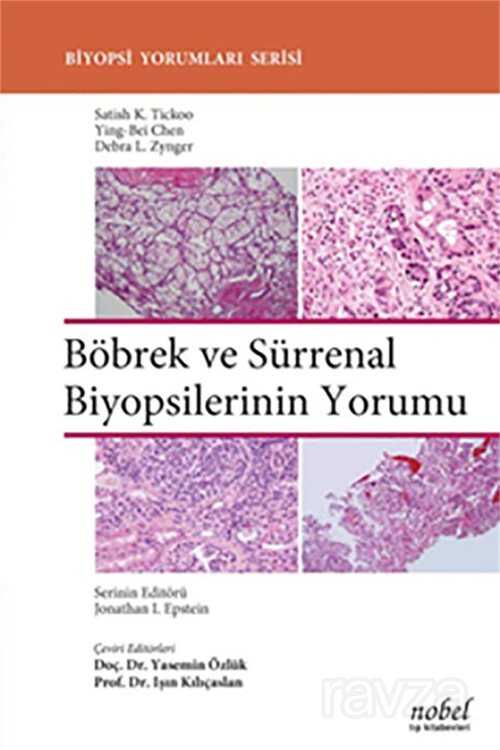 Böbrek ve Sürrenal Biyopsilerinin Yorumu - Biyopsi Yorumları Serisi - 1