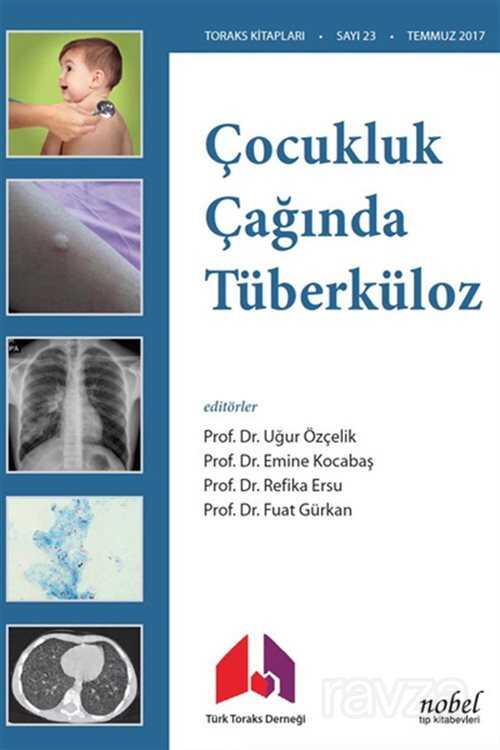 Çocukluk Çağında Tüberküloz Tanı: Tedavi ve Korumada Güncel Yaklaşımlar ve Olgu Örnekleri - 1