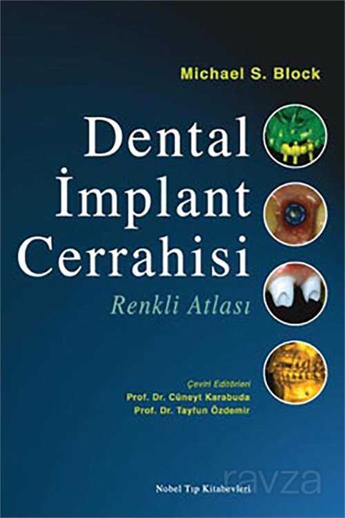 Dental İmplant Cerrahisi Renkli Atlası - 1