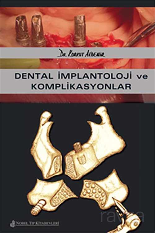 Dental İmplantoloji ve Komplikasyonlar - 1