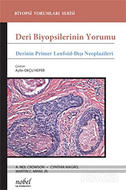 Deri Biyopsilerinin Yorumu: Derinin Primer Lenfoid-Dışı Neoplazileri - 1