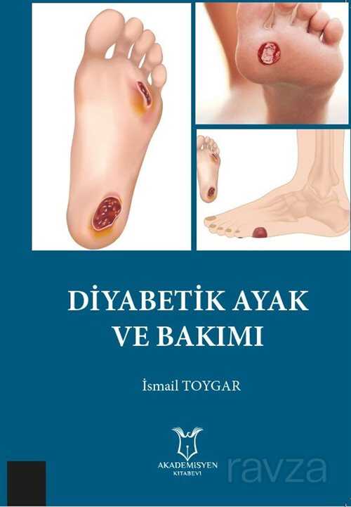 Diyabetik Ayak ve Bakımı - 1