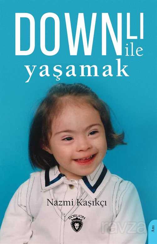 Downlı ile Yaşamak - 1