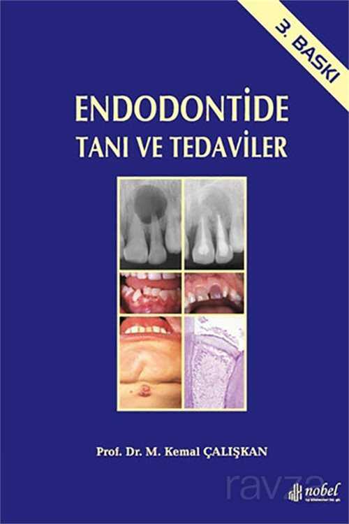 Endodontide Tanı ve Tedaviler - Nobel Tıp Kitabevleri