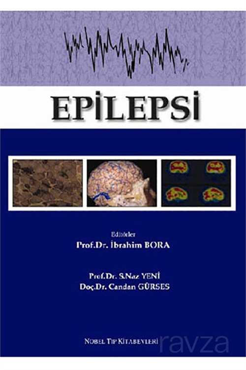 Epilepsi - 1