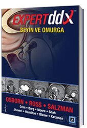 Expert DDX: Beyin ve Omurga - Pelikan Tıp Teknik Yayınları