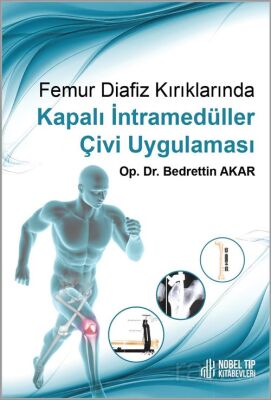 Femur Diafiz Kırıklarında Kapalı I?ntramedu¨ller C¸ivi Uygulaması - 1