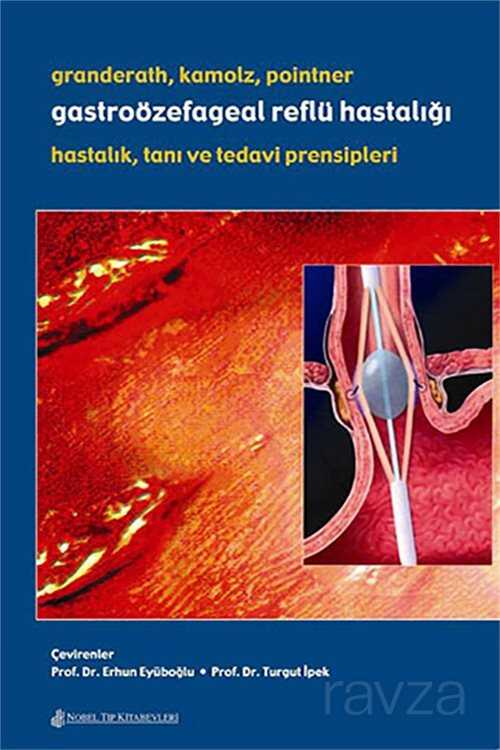 Gastroözefageal Reflü Hastalığı: Hastalık Tanı ve Tedavi Prensipleri - 1