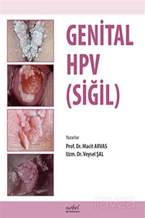 Genital HPV (SİĞİL) - 1