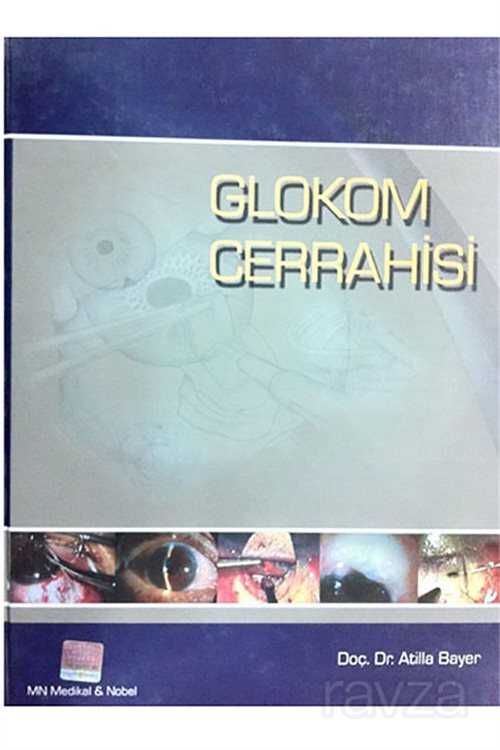 Glokom Cerrahisi - 1