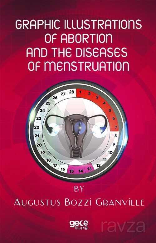 Graphic Illustrations Of Abortion And The Diseases Of Menstruation - Gece Kitaplığı