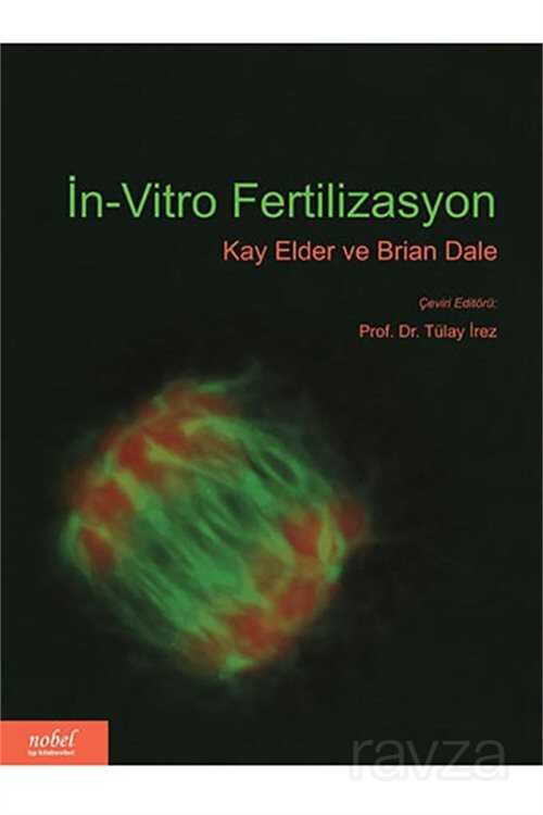 İn-Vitro Fertilizasyon - Nobel Tıp Kitabevleri