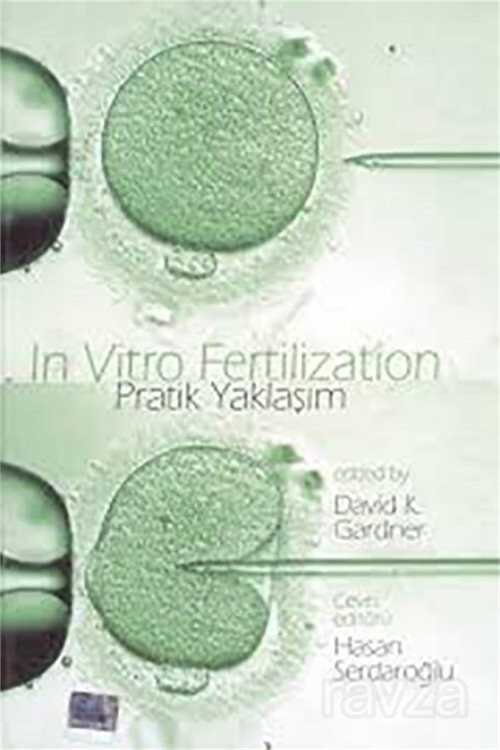 In Vitro Fertilization Pratik Yaklaşım - 1