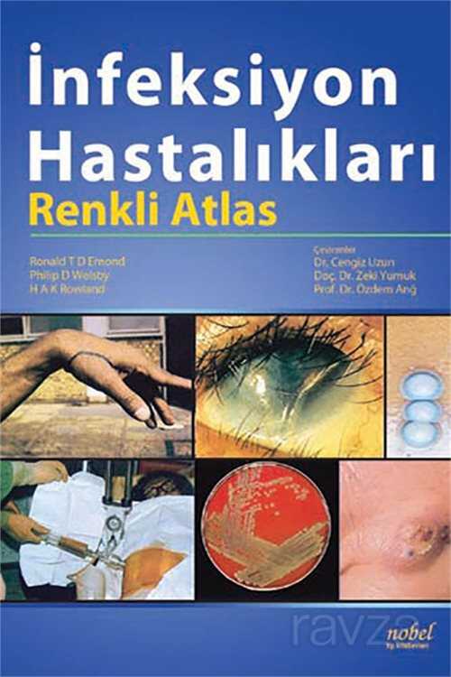 İnfeksiyon Hastalıkları: Renkli Atlas - Nobel Tıp Kitabevleri