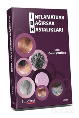 İnflamatuar Bağırsak Hastalıkları - 1