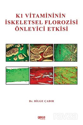 K1 Vitamininin İskeletsel Florozisi Önleyici Etkisi - 1