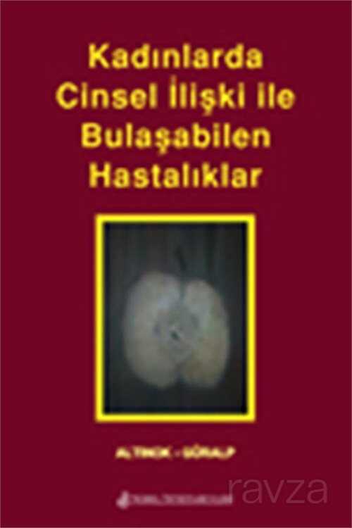Kadınlarda Cinsel İlişki İle Bulaşabilen Hastalıklar - Nobel Tıp Kitabevleri