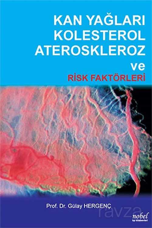 Kan Yağları Kolesterol Ateroskleroz ve Risk Faktörleri - Nobel Tıp Kitabevleri