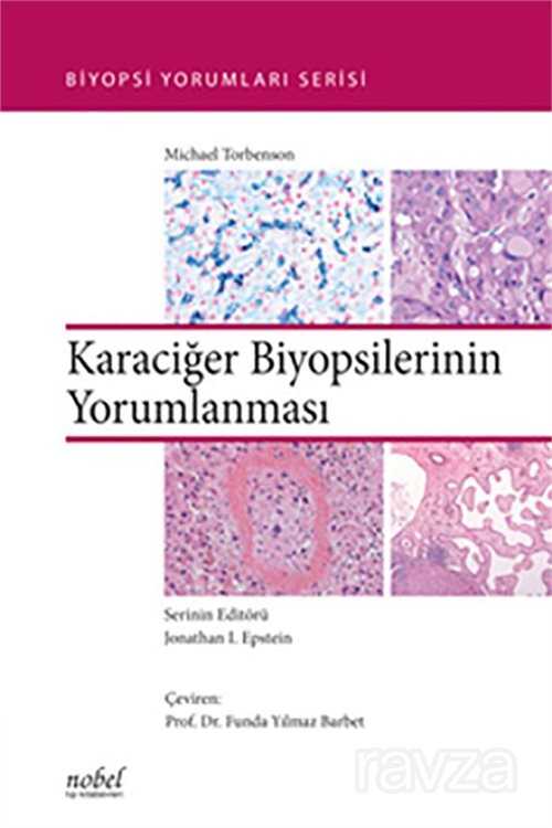 Karaciğer Biyopsilerinin Yorumlanması - Biyopsi Yorumları Serisi - 1