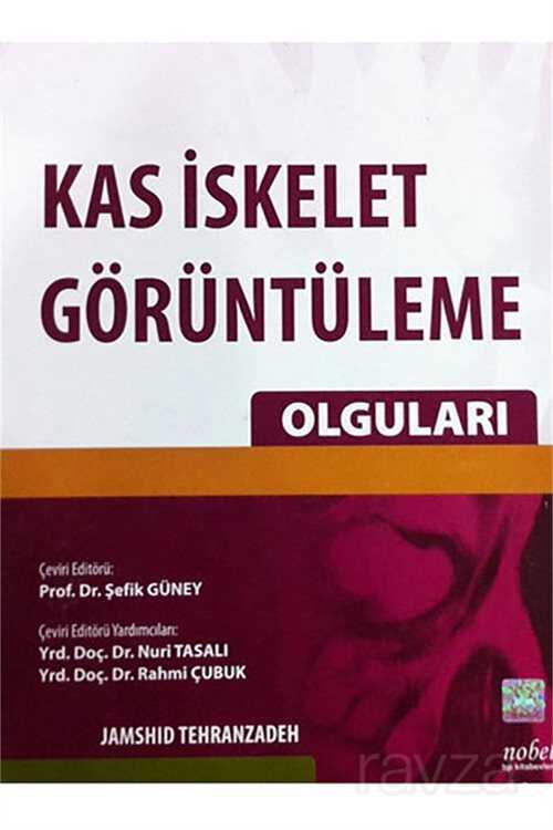 Kas İskelet Görüntüleme Olguları - 1