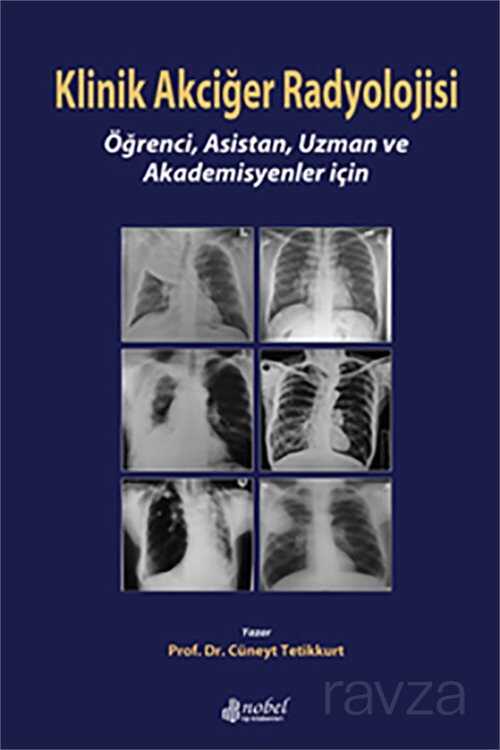 Klinik Akciğer Radyolojisi: Öğrenci, Asistan, Uzman ve Akademisyenler için - Nobel Tıp Kitabevleri