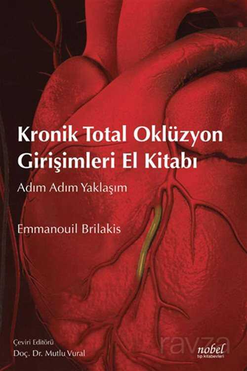 Kronik Total Oklüzyon Girişimleri El Kitabı: Adım Adım Yaklaşım - 1