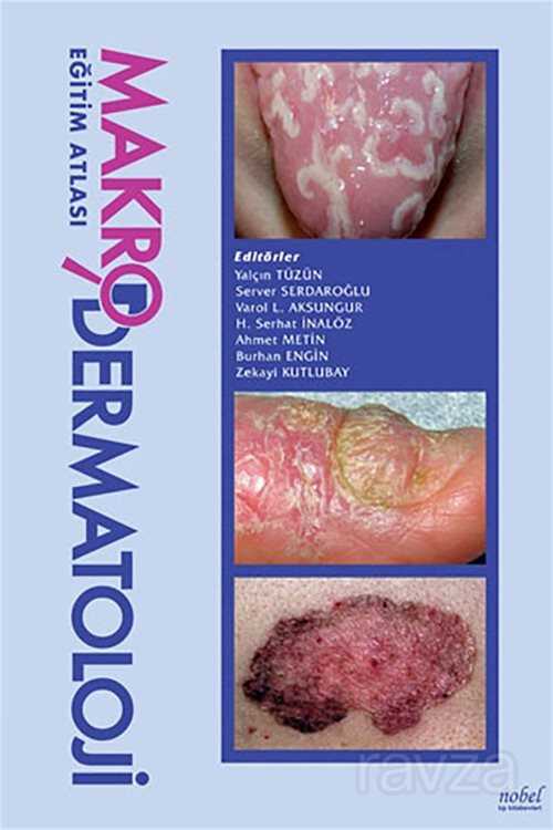 Makro Dermatoloji Eğitim Atlası - Nobel Tıp Kitabevleri