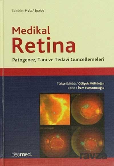Medikal Retina - 1