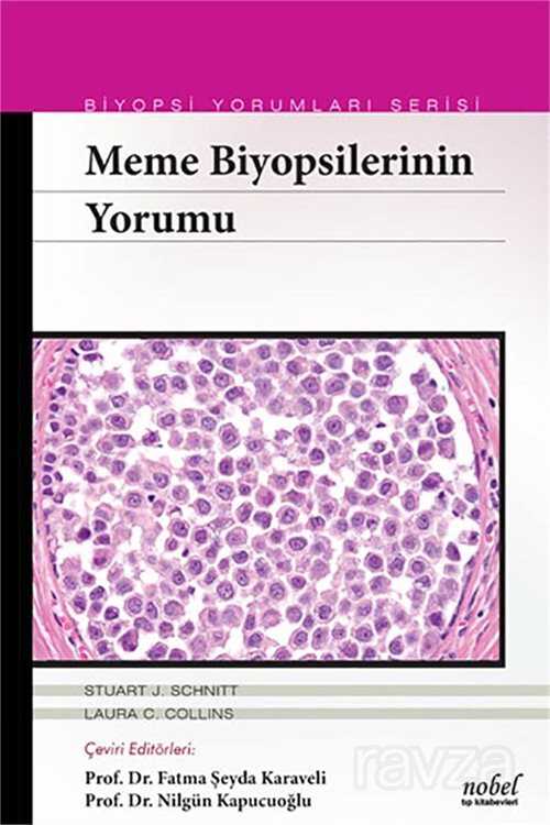 Meme Biyopsilerinin Yorumu - Biyopsi Yorumları Serisi - 1