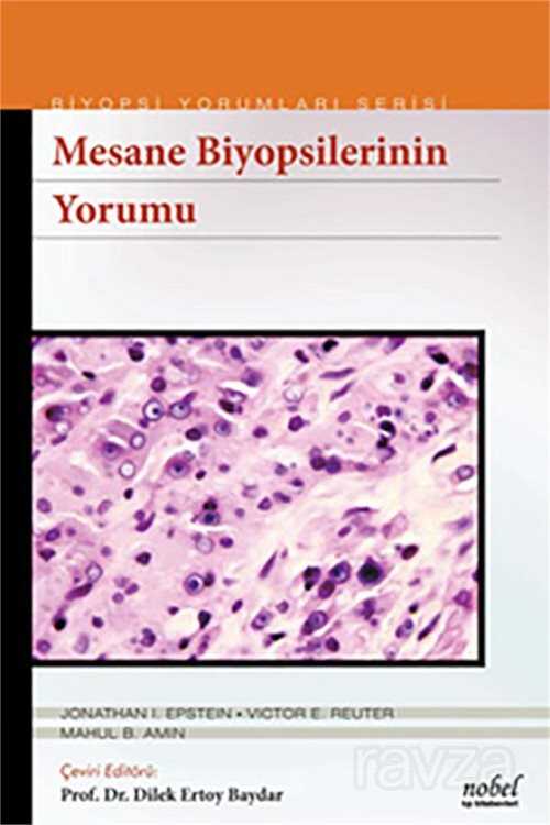 Mesane Biyopsilerinin Yorumu - Biyopsi Yorumları Serisi - 1