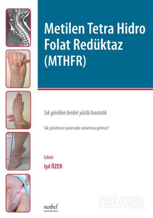 Metilen Tetra Hidro Folat Redüktaz (MTHFR) - 1