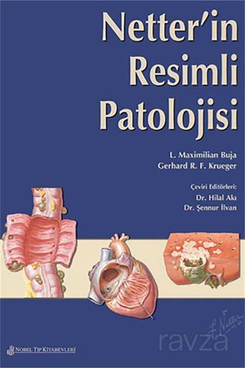 Netter'in Resimli Patolojisi - 1