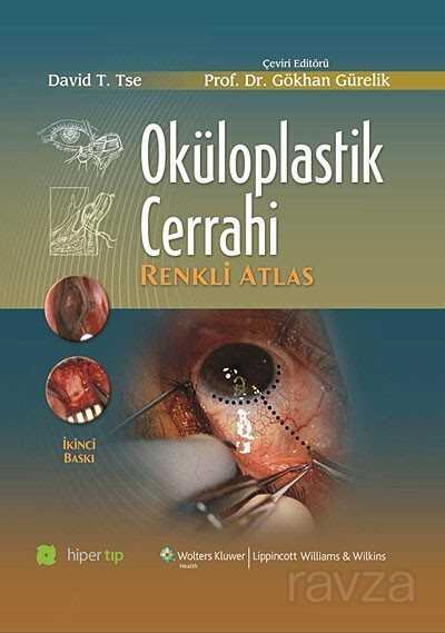 Oküloplastik Cerrahi - 1