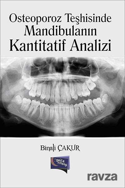 Osteoporoz Teşhisinde Mandibulanın Kantitatif Analizi - 1