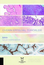 Overin Epitelyal Tümörleri - Akademisyen Kitabevi