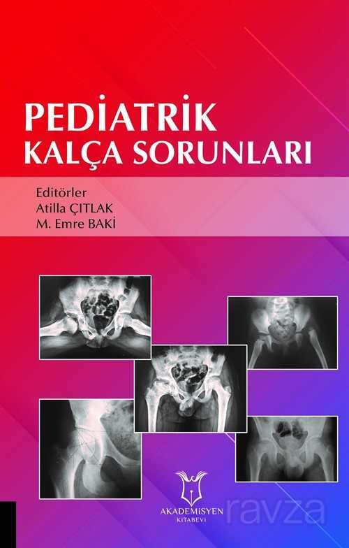 Pediatrik Kalça Sorunları - 1