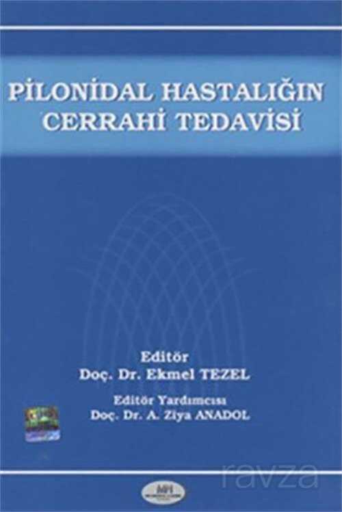 Plonidal Hastalığın Cerrahi Tedavisi - 1