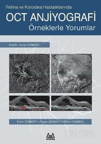 Retina ve Koroidea Hastalıklarında OCT Anjiyografi - 1