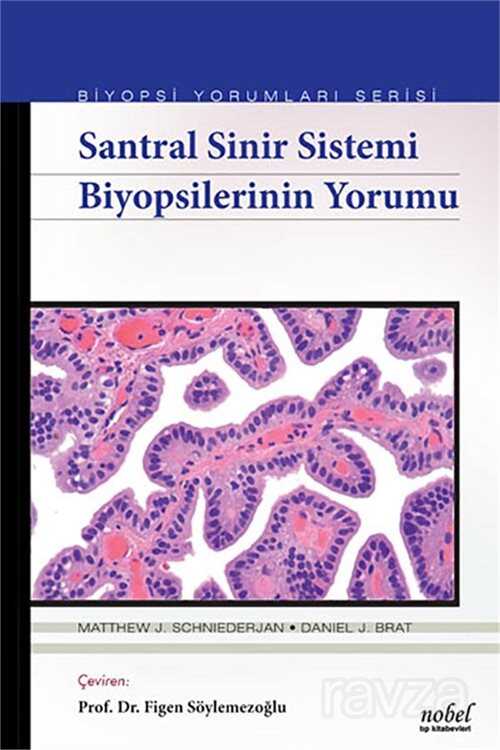 Santral Sinir Sistemi Biyopsilerinin Yorumu - Biyopsi Yorumları Serisi - 1