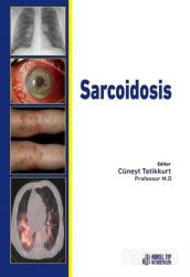 Sarcoidosis - Nobel Tıp Kitabevleri