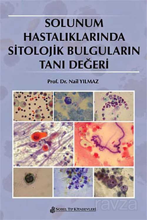 Solunum Hastalıklarında Sitolojik Bulguların Tanı Değeri - Nobel Tıp Kitabevleri