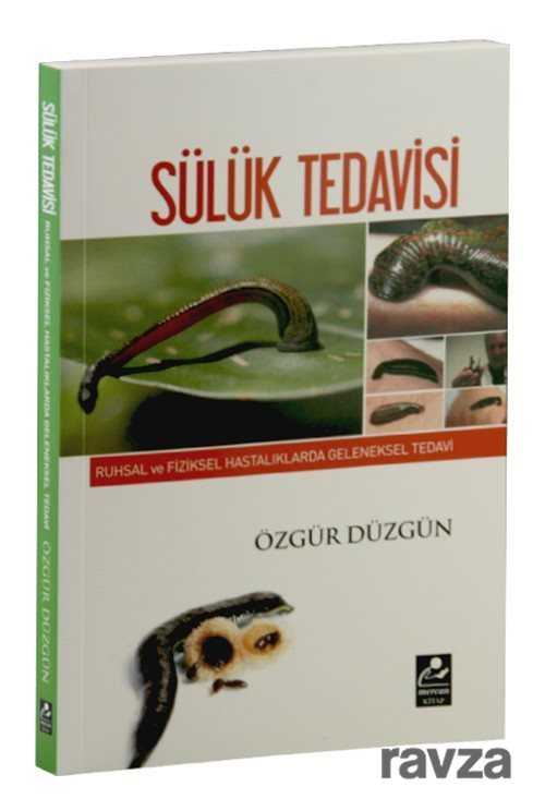 Sülük Tedavisi - Mercan Kitap